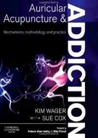 auricular acunpuncture